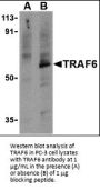 TRAF6 Antibody