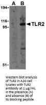 TLR2 Antibody