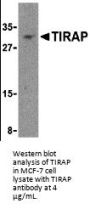 TIRAP Antibody