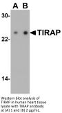 TIRAP Antibody