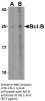 Bcl-B Antibody