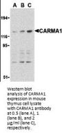 CARMA1 Antibody