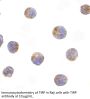 TIRP Antibody