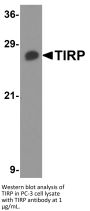 TIRP Antibody