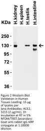ACE2 Antibody