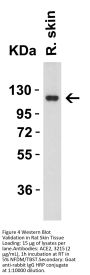 ACE2 Antibody