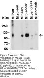 ACE2 Antibody
