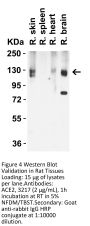 ACE2 Antibody