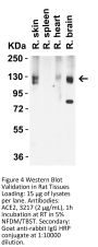 ACE2 Antibody