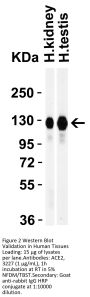 ACE2 Antibody
