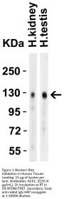 ACE2 Antibody