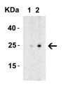 MD-2 Antibody