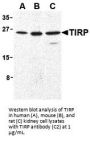 TIRP Antibody