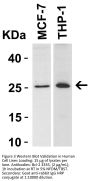 Bcl-2 Antibody