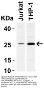 Bcl-2 Antibody