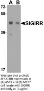 SIGIRR Antibody