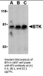BTK Antibody