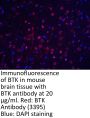 BTK Antibody