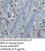BTK Antibody