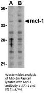 Mcl-1 Antibody