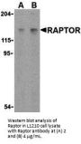 Raptor Antibody