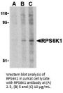 RPS6K1 Antibody