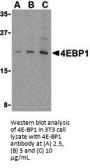 4E-BP1 Antibody