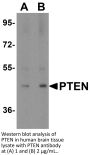 PTEN Antibody