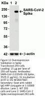 SARS-CoV-2 (COVID-19) Spike Antibody