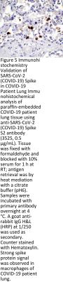 SARS-CoV-2 (COVID-19) Spike Antibody