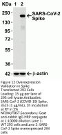 SARS-CoV-2 (COVID-19) Spike Antibody