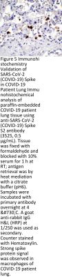 SARS-CoV-2 (COVID-19) Spike Antibody