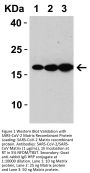 SARS-CoV Matrix Antibody