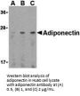Adiponectin Antibody