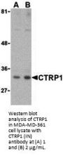 CTRP1 Antibody