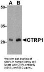 CTRP1 Antibody