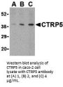CTRP5 Antibody