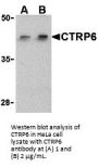 CTRP6 Antibody