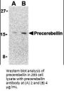 Precerebellin Antibody