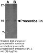 Precerebellin Antibody