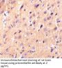 Precerebellin Antibody
