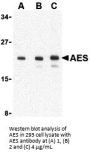 AES Antibody