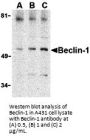 Beclin-1 Antibody