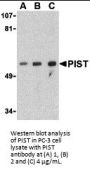 PIST Antibody