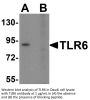 TLR6 Antibody