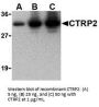 CTRP2 Antibody