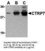 CTRP7 Antibody