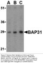 BAP31 Antibody
