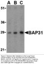 BAP31 Antibody