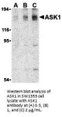 ASK1 Antibody